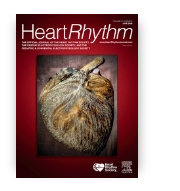 heart_rhythm.jpg