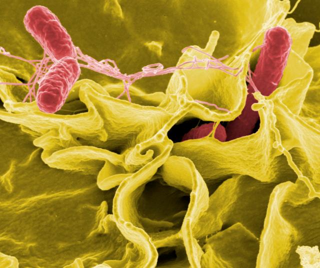 Obraz z mikroskopu przedstawiający pałeczki bakterii salmonella.