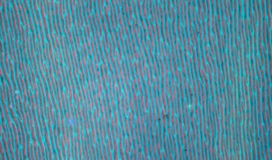 liść callierginella pod mikroskopem