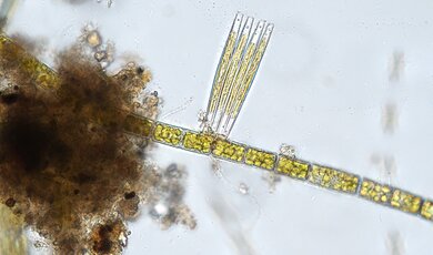 glony okrzemki pod mikroskopem