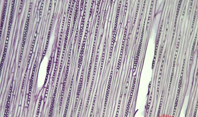 zdjęcie mikroskopowe carpinus betulus