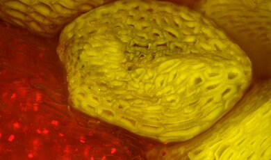 Nasienie borówki pod mikroskopem